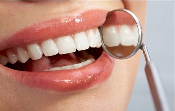 Răng yếu có nên tẩy trắng răng không? 3