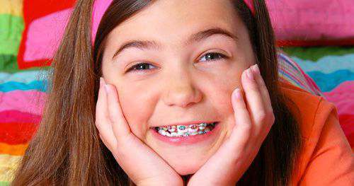 Niềng răng cho trẻ em có lợi ích gì? 4