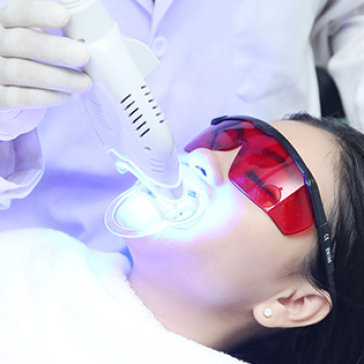 Tẩy trắng răng bằng Laser có hại không? Có biến chứng không? 3