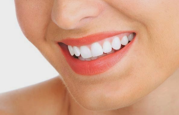 Tẩy trắng răng kiêng ăn gì để không bị nhiễm màu? 3