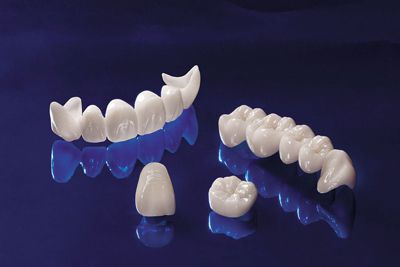 Kỹ thuật bọc răng sứ cho răng cửa 2