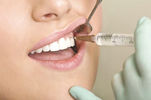 Tìm hiểu phương pháp nhổ răng hàm không đau 3
