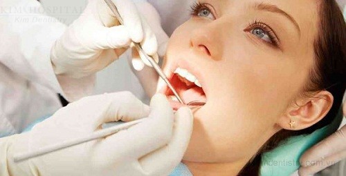 Chi phí niềng răng mắc cài inox bao nhiêu? 3
