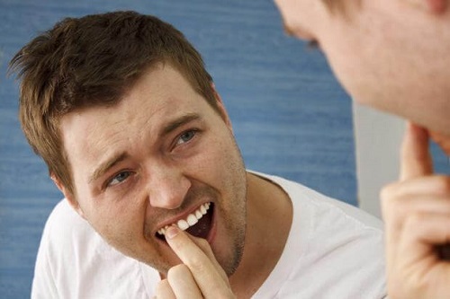 Nguyên nhân niềng răng làm răng lung lay là gì?