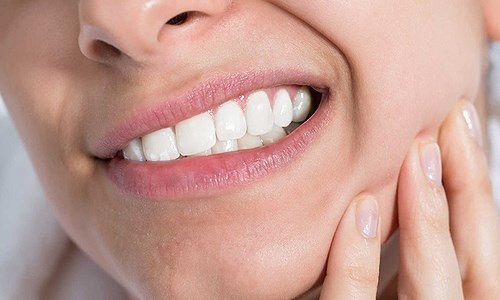 Viêm ổ răng khôn - Nguyên nhân và cách ngăn ngừa hiệu quả 1