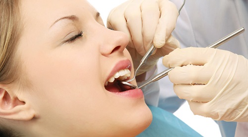 Bọc răng sứ cho răng hàm sâu hiệu quả không tái phát 1