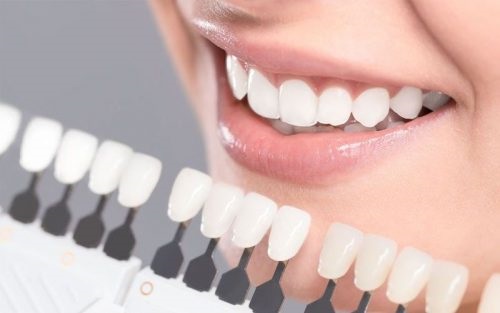 Bọc răng sứ nguyên hàm - Các thông tin liên quan 2