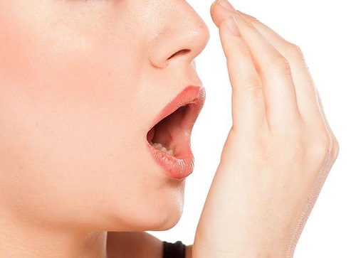 Bọc răng sứ bị hôi miệng - Nguyên nhân chính 2
